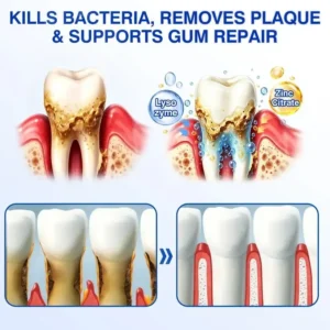 🇺🇸🏆🦷✨Alisanda® GumRevive Periodontal Repair Gel
– Savorselects