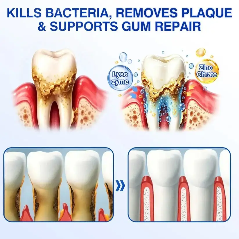 🇺🇸🏆🦷✨Alisanda® GumRevive Periodontal Repair Gel
– Savorselects