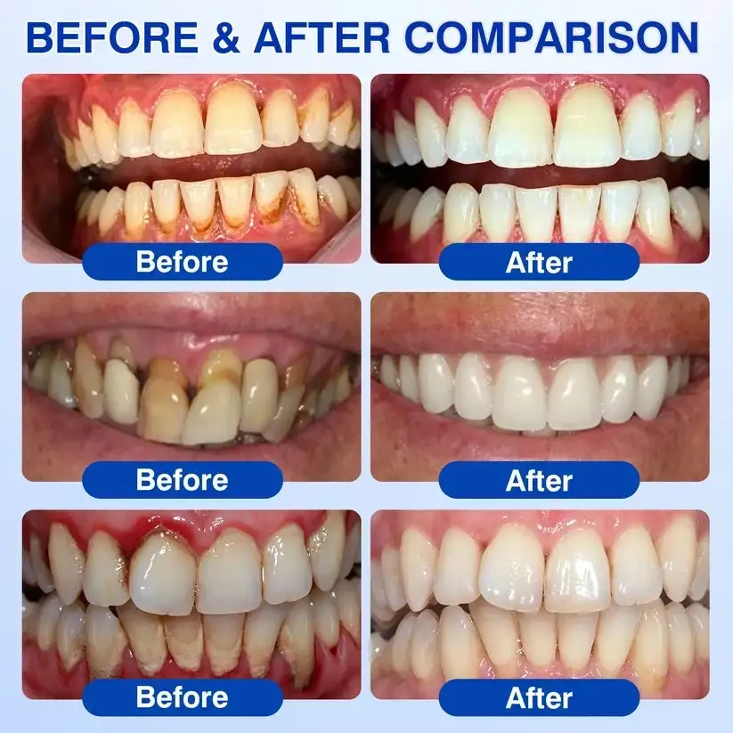 🇺🇸🏆🦷✨Alisanda® GumRevive Periodontal Repair Gel
– Savorselects