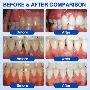 🇺🇸🏆🦷✨Alisanda® GumRevive Periodontal Repair Gel
– Savorselects