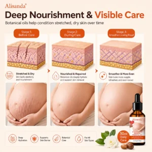Alisanda® SilkStretch Natural Stretch Mark & Scar Oil