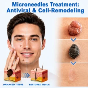 Alternative view of Alisanda® Microneedle Clear Patches